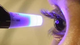 Survey: 90% glaucoma patients at risk of blindness