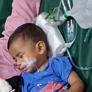 Measles outbreak claims 39 children’s lives, 32 deaths reported in just one month