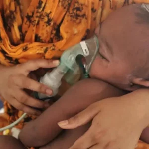 Two infants die with measles symptoms in Sylhet