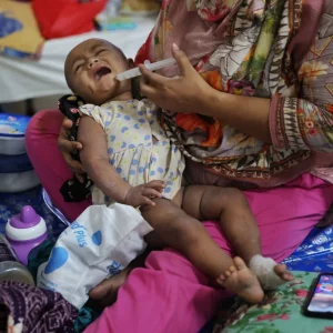 Post-measles complications on the rise among children