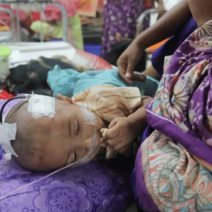 Three more children die with measles-like symptoms in Sylhet