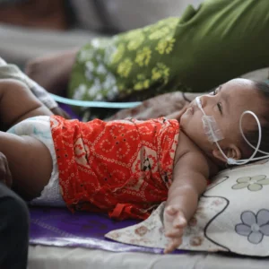 Measles outbreak: 16 more children die in 24 hours, toll reaches 528