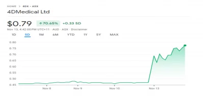 4DMedical (ASX: 4DX) Leaps 70% On Medicare Reimbursement Rates