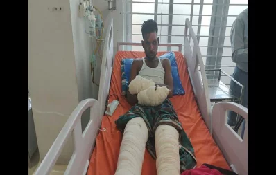 An arson attack survivor taking treatment at a hospital. Photo: Dhaka Tribune