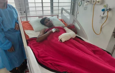 An arson attack survivor taking treatment at a hospital. Photo: Dhaka Tribune