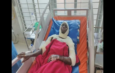 An arson attack survivor taking treatment at a hospital. Photo: Dhaka Tribune