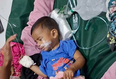 Measles patients at the Infectious Diseases Hospital in Mohakhali.
