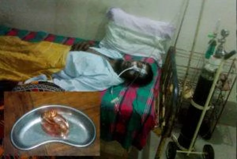 The-patient-and-the-glass-bottle--recovered-after-X-ray-from-his-stomach