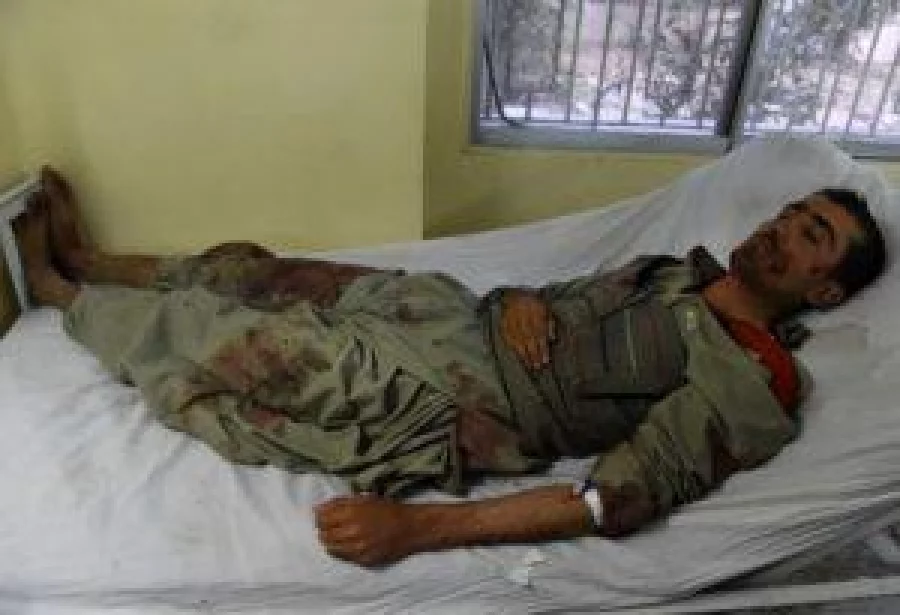 An injured Pakistani policeman lies on a bed at a hospital in Quetta on October 25, 2016, after an overnight militant attack on the Police Training College Balochistan. The death toll from an overnight attack on a police academy in southwest Pakistan has risen to 58 people with dozens more wounded, officials said, in one of the deadliest extremist attacks this year. / AFP PHOTO / BANARAS KHAN