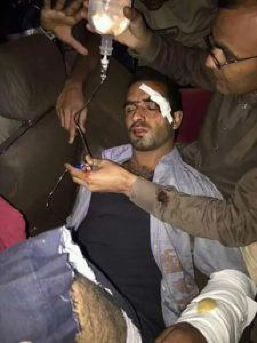 Pakistani shift an injured man, who was injured in cross-border firing, into the hospital in Nakyal sector on October 28, 2016. Pakistan accused India of killing three civilians and wounding five others in cross-border fire, as tensions soar in disputed Kashmir. / AFP PHOTO / STR