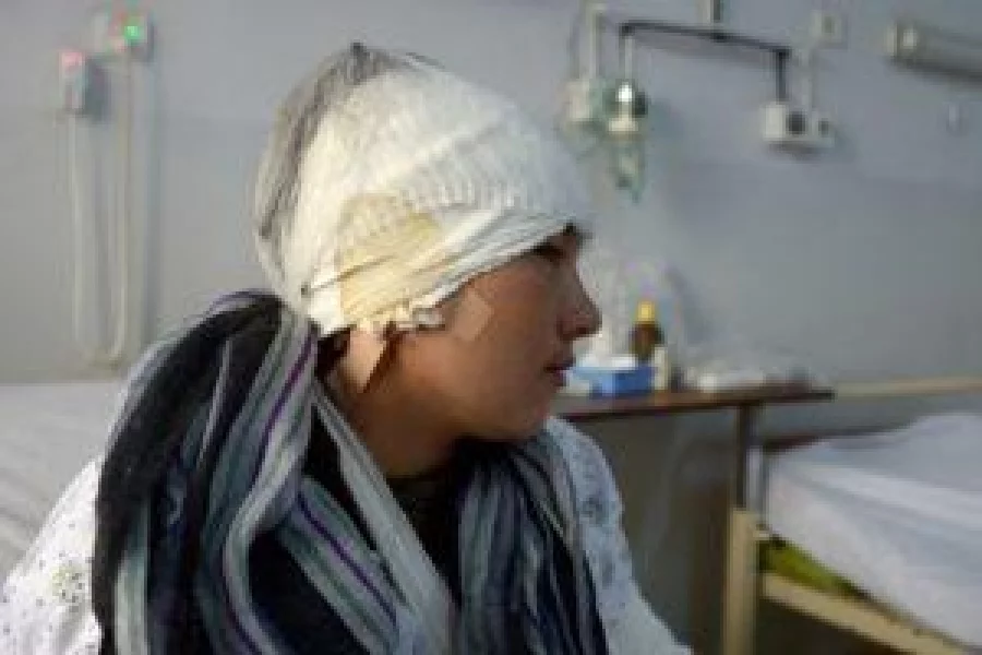 An Afghan victim of domestic violence, Zarina, 23, and whose husband cut off both her ears in an attack, sits on a bed as she receives treatment at a hospital Mazar-i- Sharif on February 2, 2017. A man in northern Afghanistan has cut off his young wife's ears, the head of a hospital caring for her said February 1, confirming the brutal act of domestic violence. The 23-year-old victim, Zarina, was attacked on the evening of January 31 in Balkh province, according to Noor Mohammad Faiz, the director of a hospital in Mazar-e-Sharif. / AFP PHOTO / FARSHAD USYAN