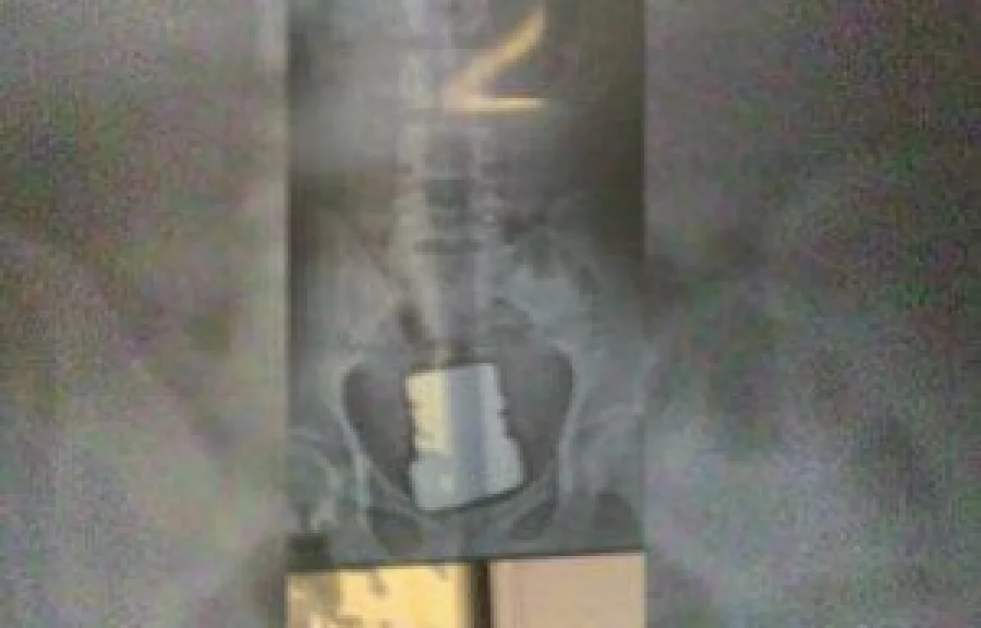 goldxray